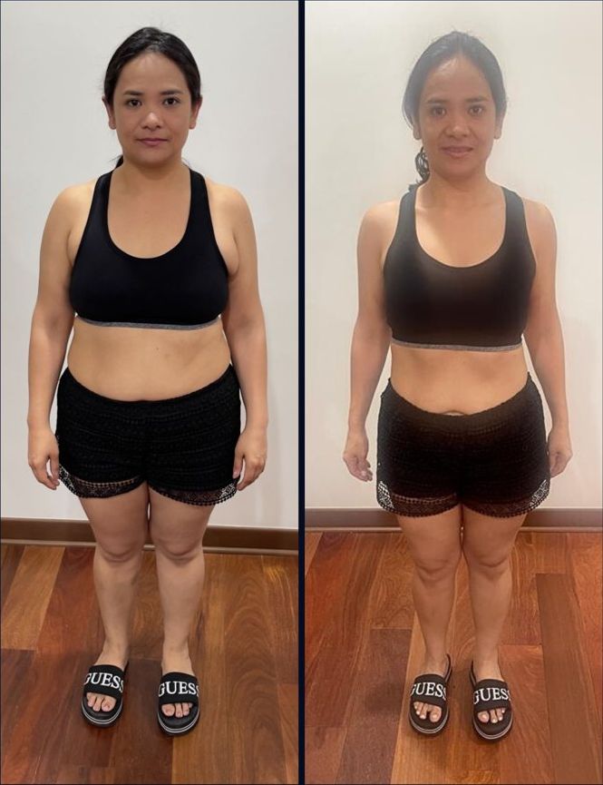 Jennifer, antes y después